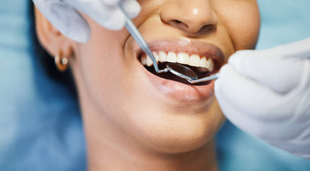 Best Emergency Dentist for Knocked-Out Tooth in Lone Tree, CO